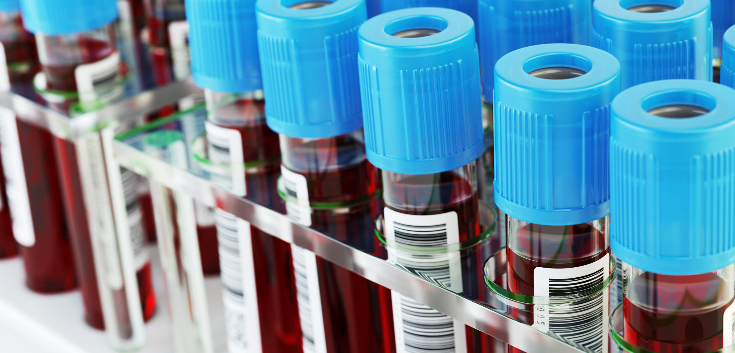 Lab technician handles a blood vial.